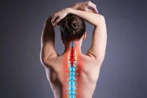 Illustration highlighting pain along the spine, showing inflammation and nerve irritation that can result from herniated discs, spinal stenosis, or pinched nerves, conditions treated at Frisco Spinal Rehab.
