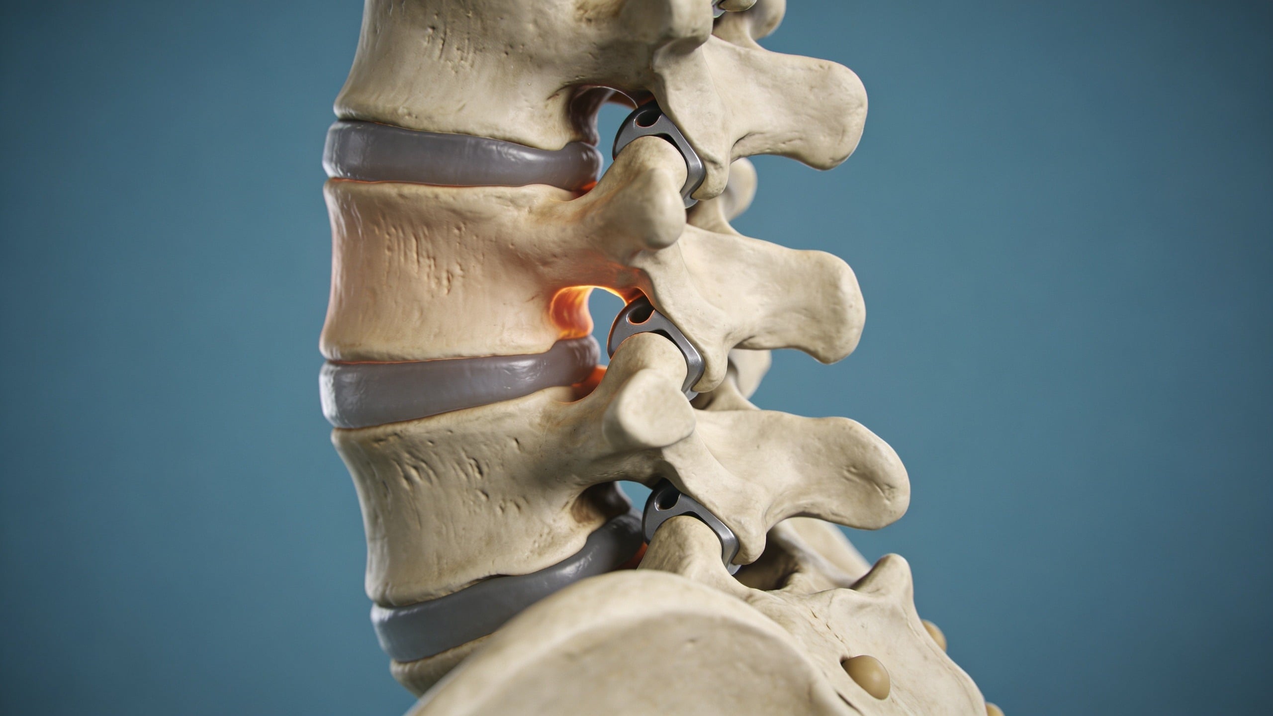 Facet joint pain and arthrosis treatment in Frisco TX with Spinal decompression