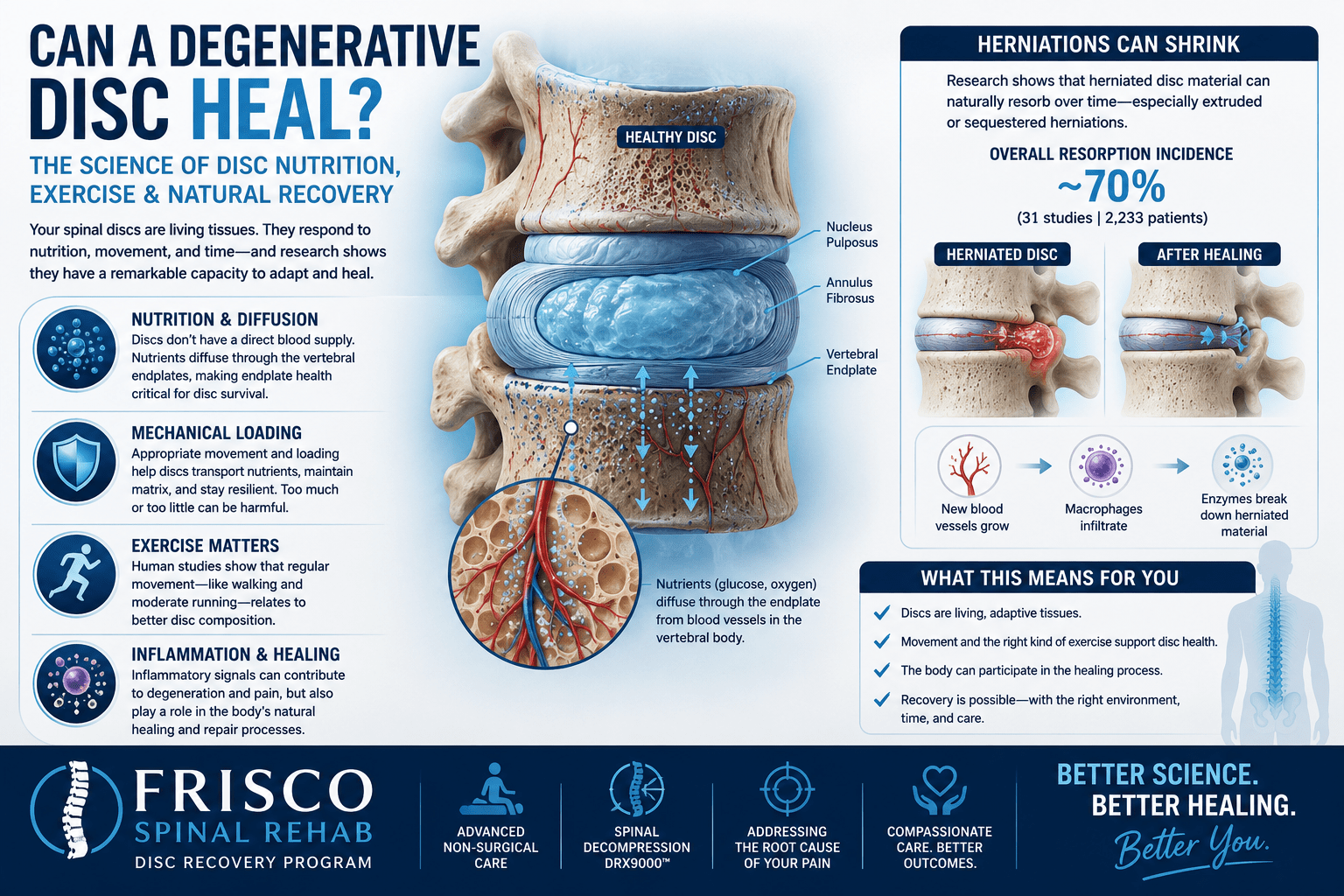 Medical infographic showing spinal disc anatomy, disc nutrition through the vertebral endplate, exercise and loading, inflammation, and natural healing of a herniated disc.