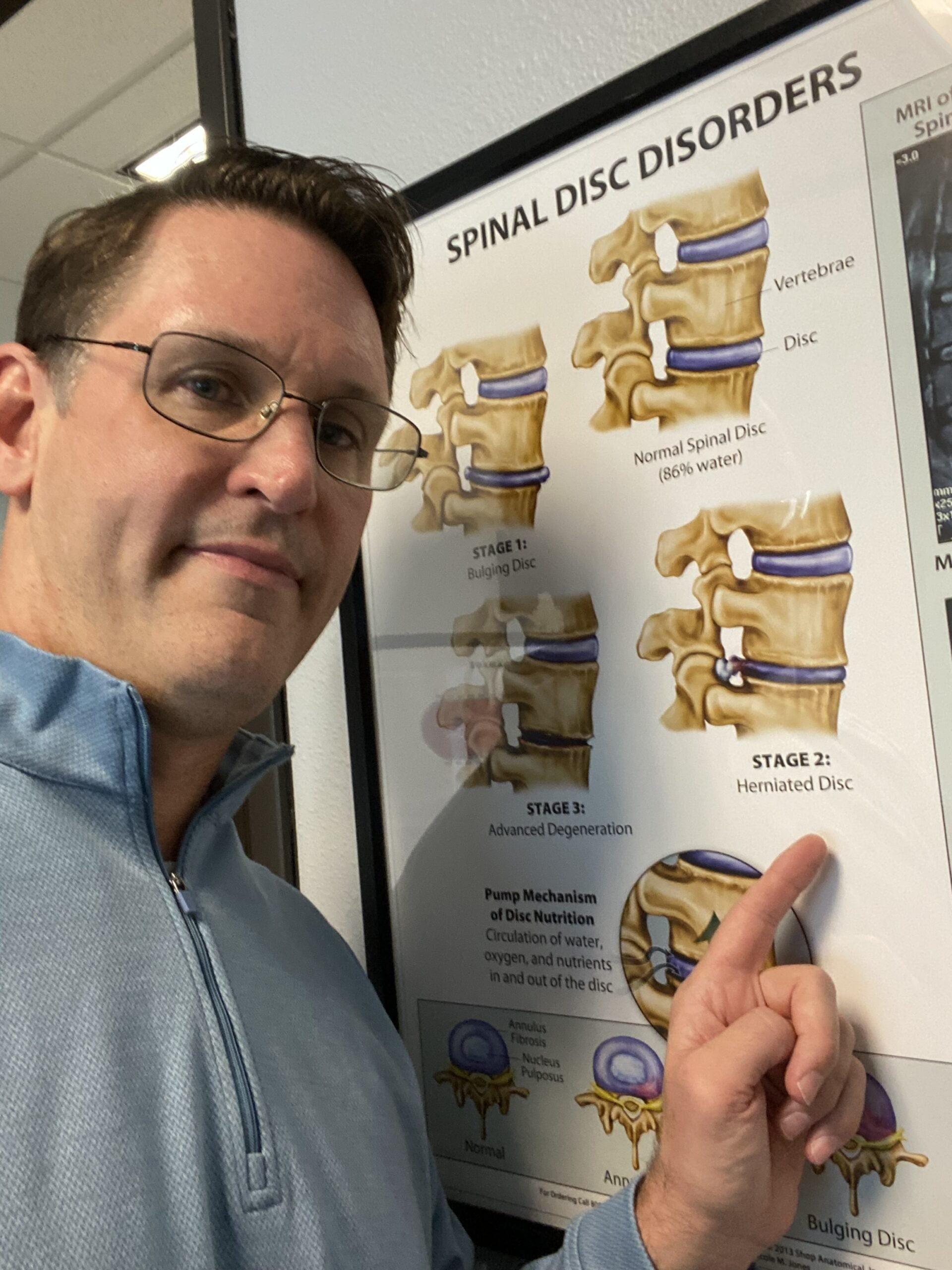 bulging disc treatment